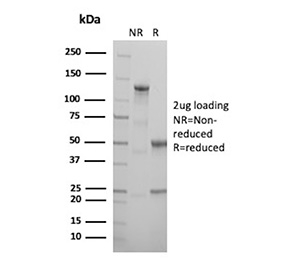 MCM5 Antibody SDS-PAGE Integrity NR vs R. SDS-PAGE analysis of antibody integrity under non-reducing (NR) and reducing (R) conditions using MCM5 antibody clone MCM5/13320R. Under reducing conditions, bands corresponding to antibody heavy and light chains are observed, confirming expected antibody structure.