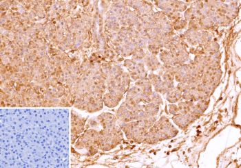 IHC staining of FFPE human pancreas tissue with recombinant MIC2/CD99 antibody (clone MIC2/9939R). Pancreatic epithelial cells demonstrate membranous and cytoplasmic staining. Inset: PBS instead of primary antibody; secondary only negative control. HIER: boil tissue sections in pH 9 10mM Tris with 1mM EDTA for 45 min at 95oC followed by cooling at RT for 20 minutes.