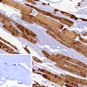 Immunohistochemistry analysis of Beta-Myosin Heavy Chain / MYH7 antibody (clone MYH7/9969R) in human skeletal muscle tissue. Formalin-fixed, paraffin-embedded human skeletal muscle section shows strong cytoplasmic brown chromogenic staining in type I slow-twitch muscle fibers consistent with MYH7 expression, while adjacent fibers show weaker staining and nuclei appear blue. The inset shows PBS used in place of primary antibody as a negative control with no specific staining observed. Heat-induced epitope retrieval was performed by heating tissue sections in 10 mM Tris with 1 mM EDTA, pH 9.0, for 45 minutes at 95oC followed by cooling at room temperature for 20 minutes prior to staining.