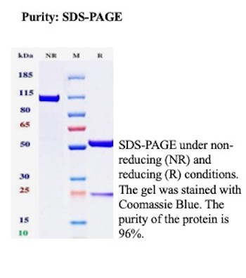SDS-PAGE Analysis of Purified CEACAM6 Recombinant Rabbit Monoclonal Antibody (CEACAM6/13371R). Confirmation of Purity and Integrity of Antibody.