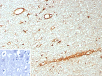 IHC staining of NTRK3/Neurotrophic receptor tyrosine kinase 3 antibody (clone NTRK3/8796). FFPE human brain tissue shows HRP-DAB brown staining in neuronal cell bodies and neuropil with membranous and cytoplasmic distribution, consistent with known expression of Neurotrophic receptor tyrosine kinase 3 in central nervous system tissue. Inset: PBS instead of primary antibody; secondary only negative control. Staining of formalin-fixed tissues requires heating tissue sections in 10mM Tris with 1mM EDTA, pH 9.0, for 45 min at 95oC followed by cooling at RT for 20 minutes.