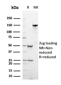 SDS-PAGE Analysis of Purified NTRK3/Neurotrophic receptor tyrosine kinase 3 antibody (NTRK3/8796). Confirmation of Purity and Integrity of Antibody.