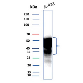 Application of SERPINE1 / PAI-1 antibody in western blot. Western blot analysis of SERPINE1 / PAI-1 antibody (clone rTJA6) was performed using human A-431 whole cell lysate. A strong immunoreactive band is observed at approximately 45 kDa, consistent with the predicted molecular weight of Serpin family E member 1. The detected signal aligns with the predicted molecular weight under reducing conditions. PAI-1 is a secreted serpin that can exist in active and latent conformations, and the slightly broadened appearance of the band likely reflects conformational states or differences in glycosylation rather than non-specific binding. The blot demonstrates specific detection of endogenous SERPINE1 in human A-431 cells at its predicted molecular weight.