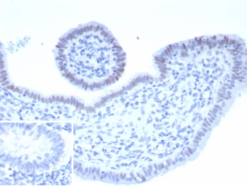 Immunohistochemistry analysis of Paired box protein 2 / PAX2 antibody in human endometrium. FFPE human endometrium tissue was stained with Paired box protein 2 / PAX2 antibody (clone rPAX2/8506). HRP-DAB brown chromogenic signal is observed predominantly in the nuclei of glandular epithelial cells lining the endometrial glands, consistent with the expected nuclear localization of PAX2. Stromal cells show minimal to no specific staining. Nuclei are counterstained blue. The inset image shows PBS used instead of primary antibody, demonstrating absence of specific HRP-DAB brown staining and confirming staining specificity. Heat-induced epitope retrieval was performed in 10 mM Tris with 1 mM EDTA, pH 9.0, for 45 minutes at 95oC followed by cooling at room temperature for 20 minutes prior to antibody incubation.