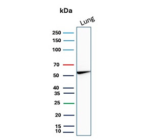 Western blot analysis of Alpha-1 Proteinase Inhibitor / AAT antibody in human lung. Western blot was performed using Alpha-1 Proteinase Inhibitor / AAT antibody (clone AAT/4487) on human lung tissue lysate. A distinct immunoreactive band is detected at approximately 52 kDa, consistent with the predicted molecular weight of SERPINA1, also known as Alpha-1 Proteinase Inhibitor. The band may appear slightly diffuse, which is consistent with the glycosylated nature of this secreted serpin. The detected signal corresponds to the predicted molecular weight under reducing conditions. Expression in lung tissue aligns with the physiologic role of Alpha-1 Proteinase Inhibitor in protecting alveolar structures from neutrophil elastase-mediated damage, supporting specific detection of endogenous AAT.