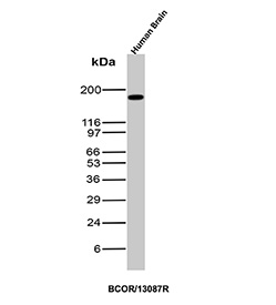 Western blot analysis of Transcriptional Corepressor BCOR antibody in human brain tissue lysate. Human brain lysate shows a distinct band at approximately 190 kDa, consistent with the predicted molecular weight of BCOR. The signal appears as a single predominant band with minimal background, supporting specific detection of endogenous BCL-6 corepressor protein in neural tissue. BCOR is known to localize to the nucleus and function as a chromatin-associated transcriptional corepressor, and the observed band aligns with the expected full-length protein size under reducing SDS-PAGE conditions.