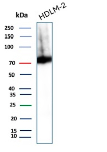 Western blot analysis of Cytotoxic Lymphocyte Perforin Antibody in HDLM-2 cell lysate. HDLM-2 lysate shows a prominent band at approximately 70 kDa, consistent with the predicted molecular weight of Perforin-1. The signal appears as a strong, specific band under reducing SDS-PAGE conditions, with minor higher molecular weight signal that may represent protein aggregation or incompletely reduced species. The observed band aligns with endogenous PRF1 expression, which is expected in activated or cytotoxic lymphoid cell populations.