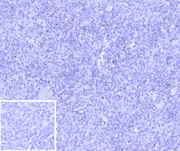 Immunohistochemistry analysis of Cytotoxic Lymphocyte Perforin Antibody in human spleen tissue. Formalin-fixed, paraffin-embedded human spleen stained with Perforin-1 Recombinant Rabbit Monoclonal Antibody (clone PRF1/9681R) demonstrates punctate cytoplasmic HRP-DAB brown staining in scattered lymphoid cells within the white pulp, consistent with perforin localization in cytotoxic T lymphocytes and natural killer cells. The majority of surrounding lymphocytes are negative, highlighting the restricted expression pattern of PRF1 in activated cytotoxic subsets. The inset image shows the negative control in which PBS was used in place of the primary antibody, confirming absence of non-specific secondary antibody staining. Heat-induced epitope retrieval was performed by boiling tissue sections in pH 9, 10mM Tris with 1mM EDTA for 45 minutes at 95oC followed by cooling prior to immunostaining.