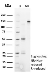 SDS-PAGE Analysis of Purified Cytotoxic Lymphocyte Perforin/PRF1 antibody (PRF1/9681R). Confirmation of Purity and Integrity of Antibody.