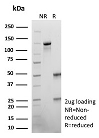 SDS-PAGE Analysis of Purified ZNF797/Spalt-like Transcription Factor 4 antibody (SALL4/12615). Confirmation of Purity and Integrity of Antibody.