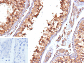 Immunohistochemistry analysis of PTGS2 / Prostaglandin-Endoperoxide Synthase 2 antibody in human testis. Formalin-fixed, paraffin-embedded human testis tissue was stained with COX-2 Recombinant Mouse Monoclonal Antibody (clone r4H12). Tumor cells show cytoplasmic brown chromogenic staining consistent with Cyclooxygenase 2 expression, while nuclei are counterstained blue. The staining pattern is predominantly cytoplasmic within epithelial cells. Inset: PBS was used in place of the primary antibody as a secondary antibody-only negative control and shows no specific staining. Heat-induced epitope retrieval was performed in 10mM Tris with 1mM EDTA, pH 9.0, for 45 min at 95oC followed by cooling at room temperature for 20 minutes.
