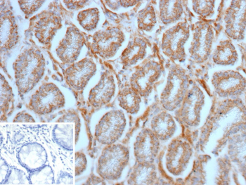 Formalin-fixed, paraffin-embedded human colon stained with SLAMF7 / CD319 Mouse Monoclonal Antibody (SLAMF7/13123). Inset: PBS instead of primary antibody; secondary only negative control.