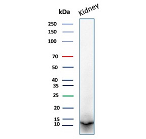 Western blot analysis of Parvalbumin / PVALB antibody (clone r2E11) in human kidney tissue lysate. A distinct immunoreactive band is observed at approximately 12 kDa, consistent with the predicted molecular weight of Parvalbumin based on its amino acid sequence. The detected band migrates in the low molecular weight range as expected for this small cytosolic EF-hand calcium-binding protein. The observed size aligns with the predicted molecular weight, with no prominent higher molecular weight non-specific bands detected under the conditions tested.