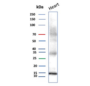 Western blot analysis of PV/Parvalbumin alpha antibody (clone rPVALB/9839) in human heart tissue lysate. A distinct immunoreactive band is observed at approximately 12 kDa, consistent with the predicted molecular weight of Parvalbumin based on its amino acid sequence. The band migrates in the expected low molecular weight range for this small cytosolic EF-hand calcium-binding protein. Faint higher molecular weight background signal may be visible above 25 kDa; however, the predominant band corresponds to the predicted molecular weight, supporting specific detection of Parvalbumin in human heart tissue.