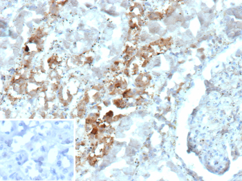 Immunohistochemistry analysis of Fast-Spiking Interneuron Marker/Parvalbumin antibody (clone PVALB/12610R) in human kidney tissue. FFPE human kidney shows cytoplasmic HRP-DAB brown staining within renal tubular epithelial cells, consistent with Parvalbumin expression. Staining is localized predominantly to the cytoplasm of tubular structures, while adjacent glomerular elements and surrounding interstitial cells demonstrate minimal specific signal. The inset image represents a secondary antibody negative control in which PBS was used in place of the primary antibody and shows absence of specific staining. Heat induced epitope retrieval was performed by heating tissue sections in 10 mM Tris with 1 mM EDTA, pH 9.0, at 95oC for 45 minutes followed by cooling at room temperature for 20 minutes prior to immunostaining.