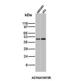 Formalin-fixed, paraffin-embedded human cervix stained with Alpha-SMA/Myofibroblast Marker antibody (clone ACTA2/13673R). Inset: PBS instead of primary antibody; secondary only negative control.