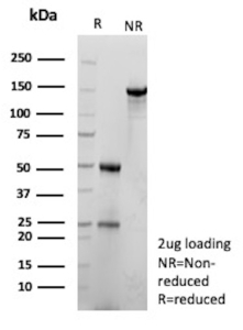 SDS-PAGE Analysis Purified CEACAM1 Mouse Monoclonal Antibody (29H2). Confirmation of Purity and Integrity of Antibody