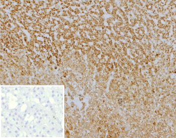 Immunohistochemistry analysis of Burkitt Lymphoma Receptor 1 antibody in human adrenal gland tissue. FFPE human adrenal sections show HRP-DAB brown membranous and cytoplasmic staining in scattered immune cells within the adrenal medulla, consistent with CXCR5, also known as CD185, expression in lymphoid-associated cells. Adrenocortical cells demonstrate minimal staining. The inset negative control, in which PBS was used in place of primary antibody, shows no specific brown chromogenic signal. Heat induced epitope retrieval was performed in 10 mM Tris with 1 mM EDTA, pH 9.0, by heating at 95oC for 45 minutes followed by cooling at room temperature for 20 minutes.