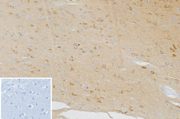 Immunohistochemistry analysis of Burkitt Lymphoma Receptor 1 antibody in human brain tissue. FFPE human brain sections show light HRP-DAB brown staining in scattered perivascular and parenchymal cells, consistent with CXCR5, also known as CD185, expression in resident or infiltrating immune-associated cells. Neuronal and glial populations demonstrate minimal background staining. The inset negative control, in which PBS was used in place of primary antibody, shows no specific brown chromogenic signal. Heat induced epitope retrieval was performed in 10 mM Tris with 1 mM EDTA, pH 9.0, by heating at 95oC for 45 minutes followed by cooling at room temperature for 20 minutes.