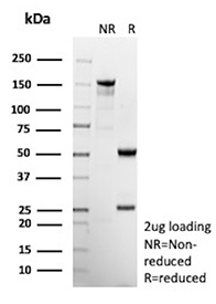SDS-PAGE Analysis of Purified C-X-C Motif Chemokine Receptor 5/CD185 antibody (clone CXCR5/13095). Confirmation of Purity and Integrity of Antibody.