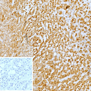 Immunohistochemistry analysis of BLR1 antibody in human adrenal gland tissue. FFPE human adrenal sections show strong HRP-DAB brown membranous and cytoplasmic staining in numerous immune-associated cells within the adrenal medulla, consistent with CXCR5, also known as CD185, expression in lymphoid cells. Adrenocortical cells demonstrate minimal background staining. The inset negative control, in which PBS was used in place of primary antibody, shows no specific brown chromogenic signal. Heat induced epitope retrieval was performed in 10 mM Tris with 1 mM EDTA, pH 9.0, by heating at 95oC for 45 minutes followed by cooling at room temperature for 20 minutes.