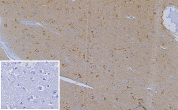 Immunohistochemistry analysis of CD185 Chemokine Receptor antibody in human adrenal gland tissue. FFPE human adrenal sections show light HRP-DAB brown membranous and cytoplasmic staining in scattered immune-associated cells within the adrenal medulla, consistent with CXCR5 expression in lymphoid cells. Adrenocortical cells demonstrate minimal background staining. The inset negative control, in which PBS was used in place of primary antibody, shows no specific brown chromogenic signal. Heat induced epitope retrieval was performed in 10 mM Tris with 1 mM EDTA, pH 9.0, by heating at 95oC for 45 minutes followed by cooling at room temperature for 20 minutes.