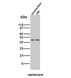 Western blot analysis of Basement Membrane Protein 40/SPARC antibody (clone r15G12) in human samples. Lysates from human brain tissue and human U87 glioblastoma cells show a distinct immunoreactive band at approximately 40-45 kDa, consistent with the predicted molecular weight of Secreted protein acidic and rich in cysteine. SPARC, also known as BM-40, is a secreted extracellular matrix protein that can exhibit slight mobility shifts on SDS-PAGE due to post-translational modifications such as glycosylation and calcium-binding related conformational properties. The observed band pattern supports detection of SPARC in both neural tissue and glioma-derived cells, consistent with reported extracellular matrix and stromal-associated expression.