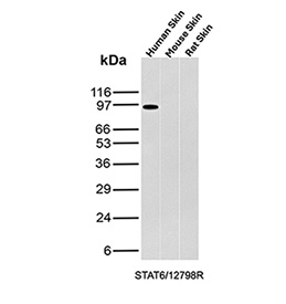 Signal Transducer 6 Antibody Skin Tissue WB. Western blot analysis of STAT6 expression in human, mouse, and rat skin tissue lysates using Signal Transducer 6 antibody clone STAT6/12798R. A band is detected at approximately 90-100 kDa in human samples, consistent with expected STAT6 expression.