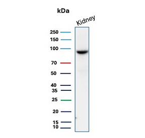 Signal Transducer 6 Antibody Kidney Tissue WB. Western blot analysis of STAT6 expression in human kidney lysate using Signal Transducer 6 antibody clone STAT6/12798R. A band is observed at approximately 90-100 kDa, consistent with the predicted molecular weight of STAT6.