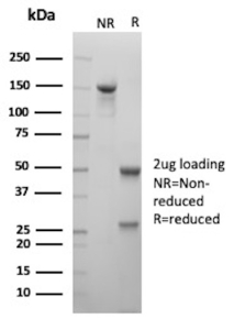 SDS-PAGE Analysis of Purified Emmprin/CD147 antibody (rAB1843). Confirmation of Purity and Integrity of Antibody.