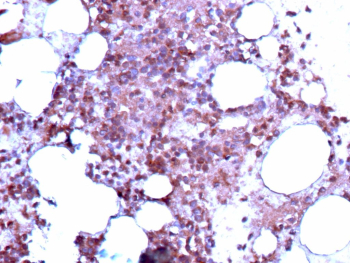 CD317 Antibody IHC. Immunohistochemistry analysis of CD317/BST2 antibody in human bone marrow tissue (clone BST2/13682R). FFPE human bone marrow sections demonstrate HRP-DAB brown membranous and cytoplasmic staining in hematopoietic cells within marrow spaces, consistent with Bone marrow stromal antigen 2 expression in immune cell populations. Megakaryocytic and mononuclear cells show prominent staining, while adipocytic spaces remain negative. Heat induced epitope retrieval was performed by boiling tissue sections in pH 9 10 mM Tris with 1 mM EDTA for 20 minutes followed by cooling prior to antibody incubation.
