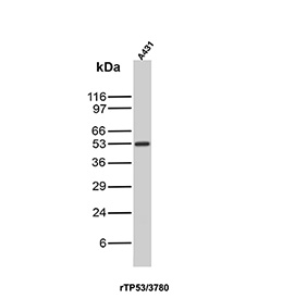 Cellular Tumor Antigen p53 Antibody / TP53 antibody (clone rTP53/3780). Western blot analysis of human A431 cell lysate shows a band at approximately 53 kDa, consistent with the predicted molecular weight of Tumor protein p53 / TP53. This result demonstrates detection of endogenous p53 protein in A431 cells by western blot.