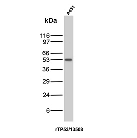 Western blot analysis of Tumor Suppressor p53 / TP53 antibody in human A431 cell lysate (clone rTP53/13508). A distinct band is observed at approximately 53 kDa, consistent with the predicted molecular weight of Tumor protein 53. The detected band corresponds to endogenous p53 expressed in A431 cells. The migration pattern aligns with the expected size of full length TP53 under reducing SDS-PAGE conditions.