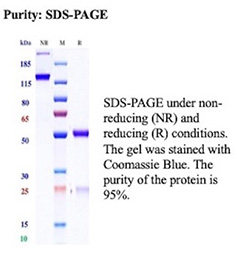 SDS-PAGE Analysis of Purified UPK2/Uroplakin 2 antibody (UPK2/13669R). Confirmation of Purity and Integrity of Antibody.