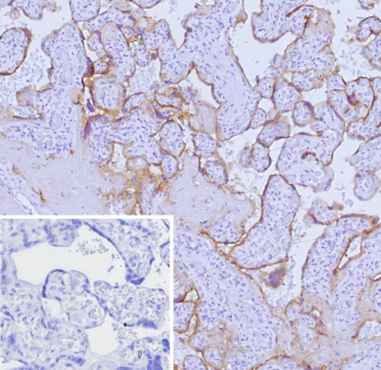 Immunohistochemistry analysis of Nectin cell adhesion molecule 4 / NECTIN4 antibody (clone NECTIN4/9906) in human placental tissue. Formalin-fixed, paraffin-embedded placenta demonstrates membranous HRP-DAB brown staining outlining trophoblastic cells within chorionic villi, consistent with surface localization of Nectin-4. The staining pattern highlights cell-cell borders with minimal background in stromal regions. Hematoxylin counterstain delineates nuclear morphology and villous architecture. The inset shows PBS used in place of primary antibody as a negative control, confirming absence of non-specific secondary antibody binding. Heat-induced epitope retrieval was performed by heating tissue sections in 10 mM Tris with 1 mM EDTA, pH 9.0, for 45 minutes at 95oC followed by cooling at room temperature for 20 minutes prior to staining.