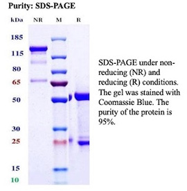 SDS-PAGE Analysis of Purified Poliovirus receptor related 4/NECTIN4 antibody (NECTIN4/13438R). Confirmation of Purity and Integrity of Antibody.
