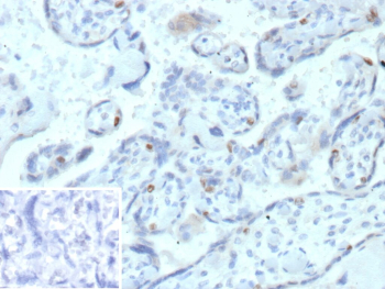 Immunohistochemistry analysis of CCNE1 / Cyclin E1 antibody (clone r13A3) in human placental tissue. Formalin-fixed, paraffin-embedded placenta demonstrates nuclear HRP-DAB brown staining in scattered trophoblastic cells, consistent with the known nuclear localization of Cyclin E1 in proliferating cells. Most stromal and non-proliferative cells remain negative, while hematoxylin counterstain highlights overall villous architecture and nuclei. The inset shows PBS used in place of primary antibody as a negative control, confirming absence of non-specific secondary antibody binding. Heat-induced epitope retrieval was performed by heating tissue sections in 10 mM Tris with 1 mM EDTA, pH 9.0, for 45 minutes at 95oC followed by cooling at room temperature for 20 minutes prior to staining.