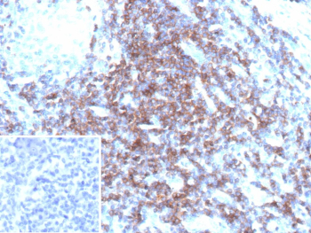 Immunohistochemistry analysis of CD3D/CD3 delta subunit antibody (clone CD3D/13089R) in human tonsil tissue. Formalin-fixed, paraffin-embedded tonsil demonstrates strong membranous HRP-DAB brown staining in interfollicular T lymphocytes, consistent with CD3 complex expression in mature T cells. Germinal center B cell areas show minimal staining, highlighting the expected T cell-restricted distribution pattern. Hematoxylin counterstain delineates nuclear morphology and tonsillar architecture. The inset shows PBS used in place of primary antibody as a negative control, confirming absence of non-specific secondary antibody binding. Heat-induced epitope retrieval was performed by heating tissue sections in 10 mM Tris with 1 mM EDTA, pH 9.0, for 45 minutes at 95oC followed by cooling at room temperature for 20 minutes prior to staining.
