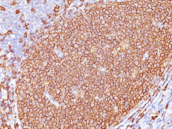 Immunohistochemistry analysis of MS4A1 Antibody / Membrane spanning 4-domains A1 in human tonsil tissue. FFPE human tonsil demonstrates strong, uniform membranous HRP-DAB brown staining in B lymphocytes within germinal centers, sharply delineating follicular architecture consistent with CD20/MS4A1 surface expression, while surrounding interfollicular regions show reduced staining. Antigen retrieval was performed by heating tissue sections in 10mM Tris with 1mM EDTA, pH 9.0, at 95oC for 45 minutes followed by cooling at room temperature for 20 minutes prior to incubation with mouse monoclonal antibodies (clones L26 + IGEL/773).