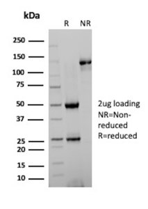 SDS-PAGE Analysis of Purified MS4A1/Membrane spanning 4-domains A1 antibody (L26 + IGEL/773). Confirmation of Purity and Integrity of Antibody.