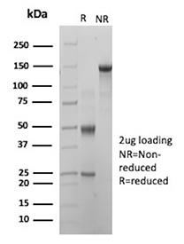 SDS-PAGE Analysis of Purified CD27/CD27 molecule antibody (clone r137B4). Confirmation of Purity and Integrity of Antibody.