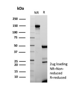 SDS-PAGE Analysis of Purified CA125 Antibody (CA125/8894). Confirmation of Purity and Integrity of Antibody.