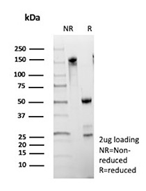 SDS-PAGE Analysis of Purified Cancer antigen 125 antibody (clone CA125/8893). Confirmation of Purity and Integrity of Antibody.