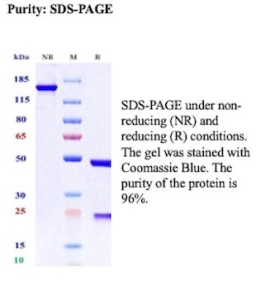 SDS-PAGE Analysis of Purified Ovarian cancer antigen 125 antibody (CA125/13895R). Confirmation of Purity and Integrity of Antibody.