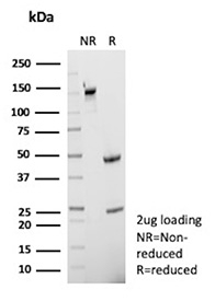 SDS-PAGE Analysis of Purified CD40 Molecule Antibody (clone r11E9). Confirmation of Purity and Integrity of Antibody.