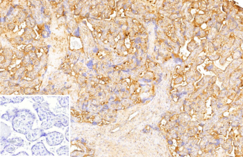 DR3 Ligand Antibody Placenta IHC. Immunohistochemistry of DR3 Ligand antibody in human placenta tissue. FFPE human placenta shows strong membranous and cytoplasmic HRP-DAB brown staining within trophoblastic epithelial cells lining chorionic villi, consistent with TNFRSF25 ligand / TNFSF15 expression in placental and endothelial-associated compartments. Clone VEGI/13117 was used as a monoclonal antibody for detection. An inset image shows PBS substituted for the primary antibody as a negative control, demonstrating absence of specific staining. Heat-induced epitope retrieval was performed by heating sections in 10 mM Tris with 1 mM EDTA, pH 9.0, for 45 minutes at 95oC followed by cooling at room temperature for 20 minutes prior to staining.