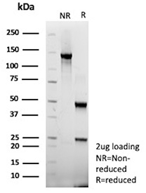 SDS-PAGE Analysis of Purified HCMV pp65/UL83 antibody (clone r6). Confirmation of Purity and Integrity of Antibody.