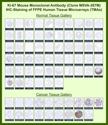 Ki-67 Antibody for IHC Tissue Microarray (TMA). Immunohistochemistry analysis of Ki-67 / MKI67 in formalin-fixed paraffin-embedded human normal and cancer tissue microarrays using mouse monoclonal antibody clone MSVA-267M. Tissue microarray (TMA) staining with HRP-DAB brown chromogen demonstrates nuclear localization in proliferating cell populations, consistent with the role of Ki-67 as a proliferation marker. In normal tissue microarrays, staining is largely restricted to physiologic proliferative compartments, including germinal centers in lymphoid tissues, basal epithelial layers, and intestinal crypt cells, while most differentiated tissues show minimal to absent signal. Within tumor tissue microarrays, many carcinomas and other malignancies display elevated fractions of Ki-67-positive nuclei, reflecting increased cellular proliferation. Evaluation across large TMA panels enables direct comparison of MKI67 expression across diverse tissue types under standardized conditions. The observed staining patterns align with reported Ki-67 expression profiles in the Human Protein Atlas and support its use as a marker of cell proliferation and tumor growth fraction.