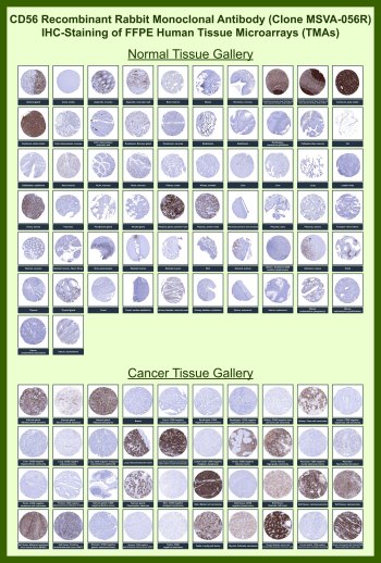 CD56 Antibody for IHC Tissue Microarray (TMA). Immunohistochemistry analysis of Neural cell adhesion molecule 1 / NCAM1 in formalin-fixed paraffin-embedded human normal and cancer tissue microarrays. Tissue microarray (TMA) staining with HRP-DAB brown chromogen demonstrates membranous and cytoplasmic localization in CD56-positive cell populations, including neural structures and subsets of immune and neuroendocrine cells, while many epithelial tissues remain largely negative. Within tumor tissue microarrays, staining highlights neuroendocrine differentiation and neural-associated tumor cell populations. Evaluation across large TMA panels enables direct comparison of NCAM1 expression across diverse tissue types under standardized conditions. The observed staining patterns align with reported CD56 expression profiles in the Human Protein Atlas and support its use as a marker of neural and neuroendocrine lineage cells.