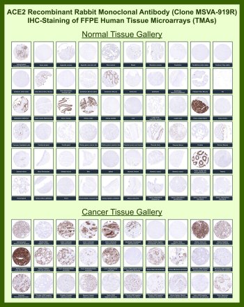 ACE2 Antibody for IHC Tissue Microarray (TMA). Immunohistochemistry analysis of Angiotensin-converting enzyme 2 ACE2 in formalin-fixed paraffin-embedded human tissue microarrays using recombinant rabbit monoclonal ACE2 antibody clone MSVA-919R. Tissue microarray (TMA) staining with HRP-DAB brown chromogen highlights epithelial cell localization, with strong signal observed in organs such as intestine and kidney, while most stromal and lymphoid tissues remain largely negative. This distribution reflects the known epithelial expression pattern of ACE2 across multiple normal and cancer tissues. The observed TMA staining profiles are consistent with ACE2 expression data reported in the Human Protein Atlas.